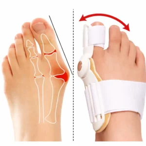 Bunion Corrector مصحح إبهام القدم الطبي لتعديل الاعوجاج وتخفيف الألم