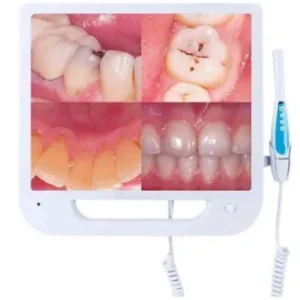 starDent Intraoral Camera
